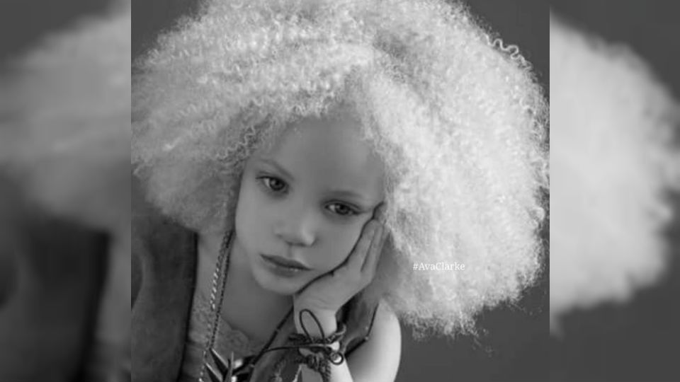Esta niña está revolucionando el mundo de la moda: sus padres son negros y  ella es albina - La Red